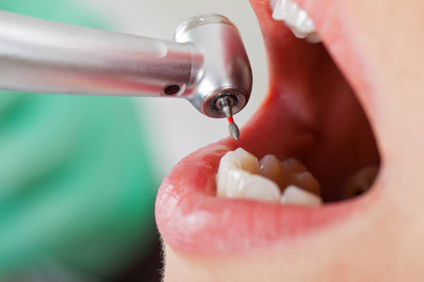 Best Emergency Dentist for Kids  in La Paloma, TX